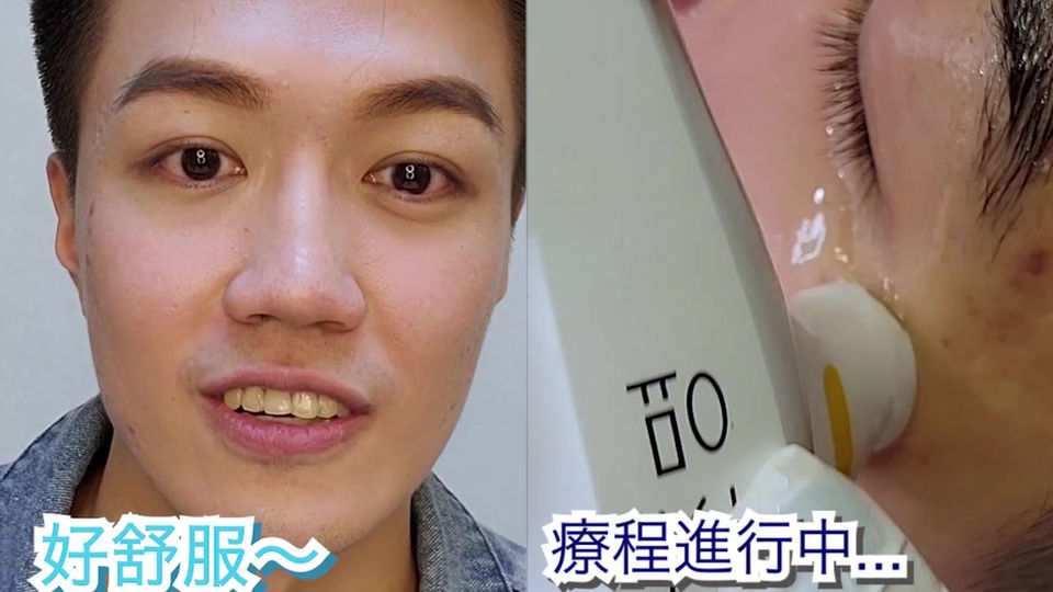 靚仔Bon 1次解決80%眼部問題